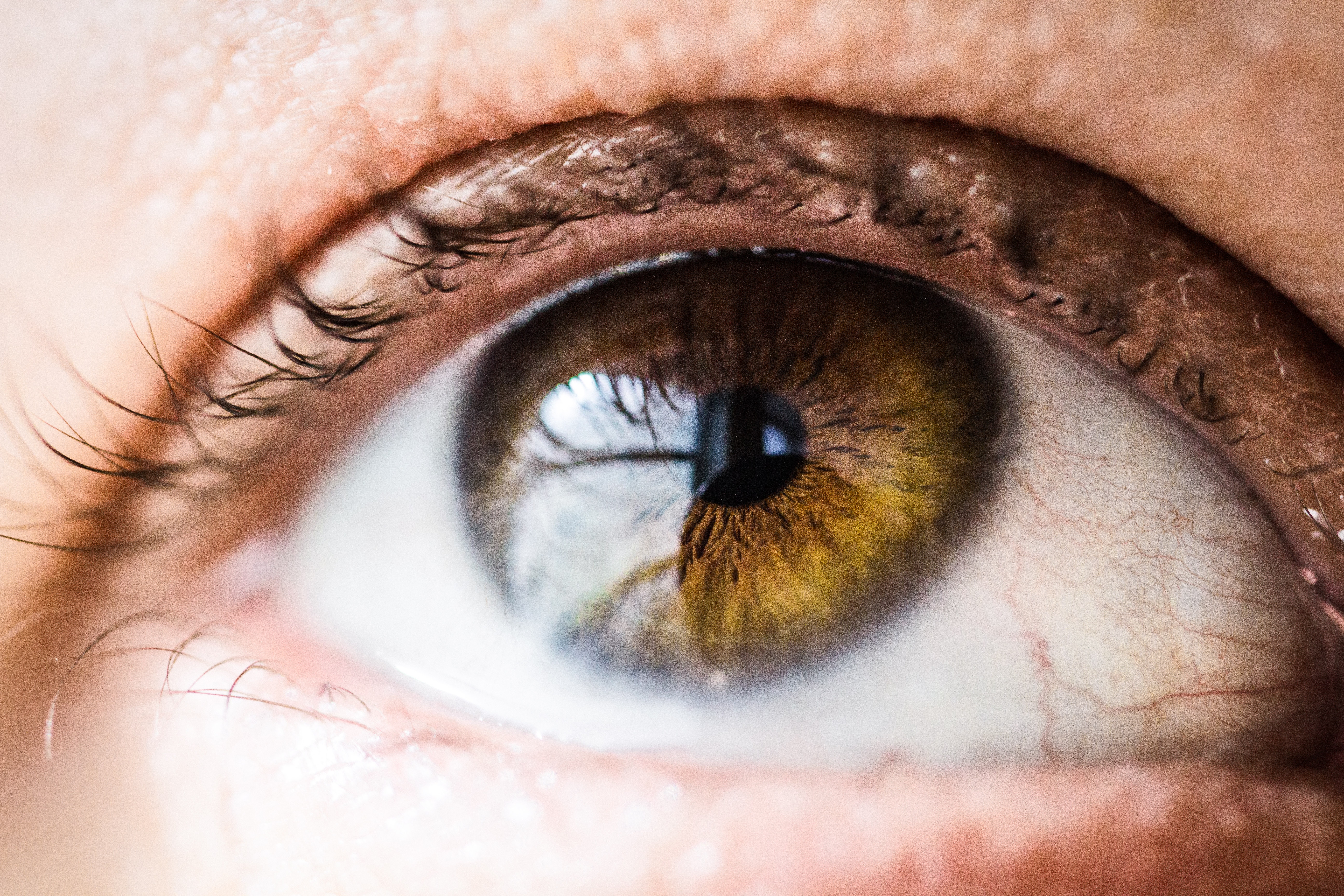 眼瞼(がんけん)ミオキミアの症状・原因から治療方法・予防対策まで徹底解説！